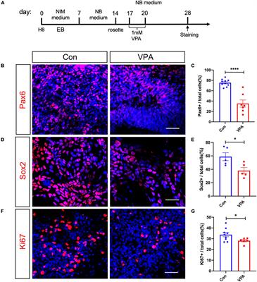 Glycolysis mediates neuron specific histone acetylation in valproic acid-induced human excitatory neuron differentiation